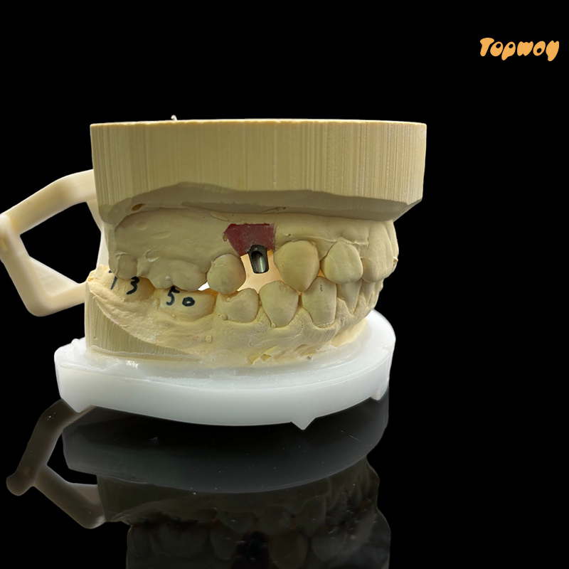 Zirconia Titanium Abutments - Image 1