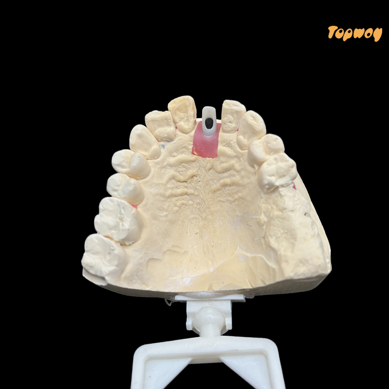 Zirconia Titanium Abutments - Image 3