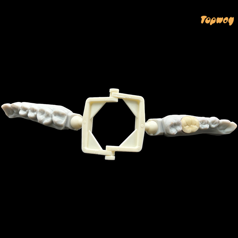 PFM Crowns and bridge (Porcelain-Fused-to-Metal) - Image 2