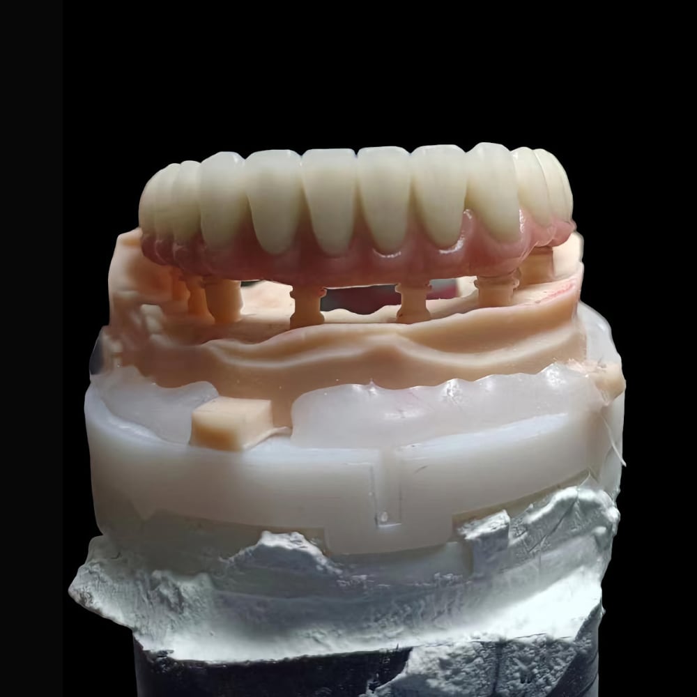 Professional Zirconia Dental Implant Crown