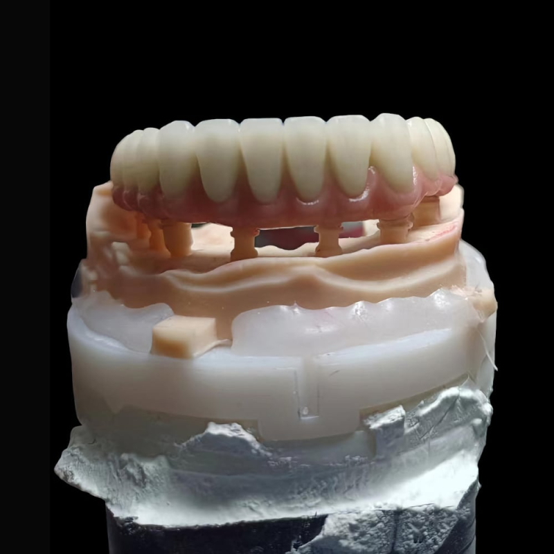 Professional Zirconia Dental Implant Crown - Image 1