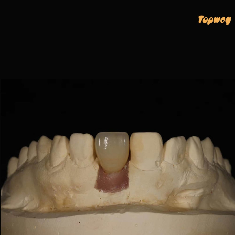 Professional Zirconia Dental Implant Crown - Image 2