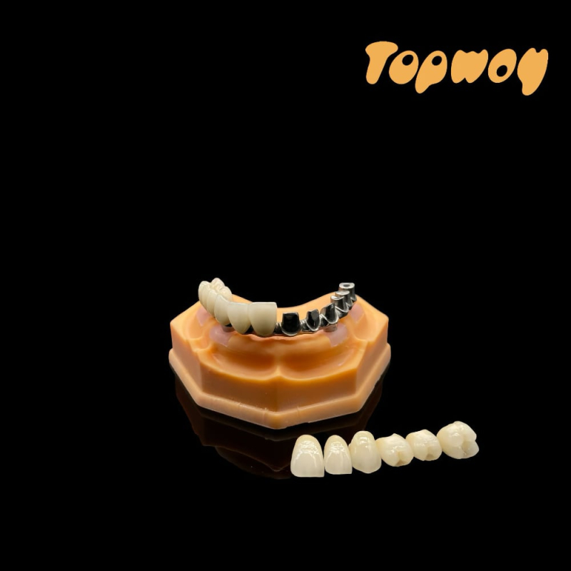 Malo Implant Bridge - Image 1