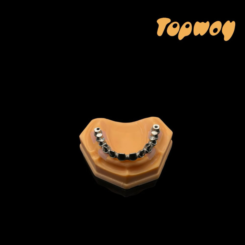 Malo Implant Bridge - Image 3