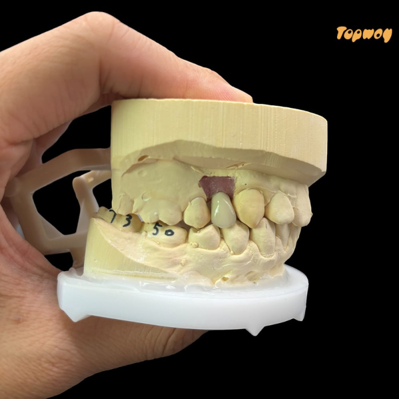 Layered Zirconia Implant Crowns And Bridge - Image 2