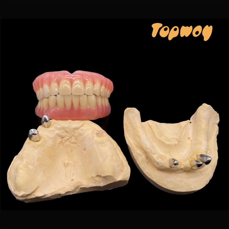 Dental Telescopes Crowns - Image 4