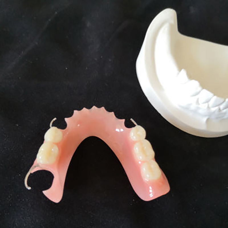Dental Flexible Denture - Image 3