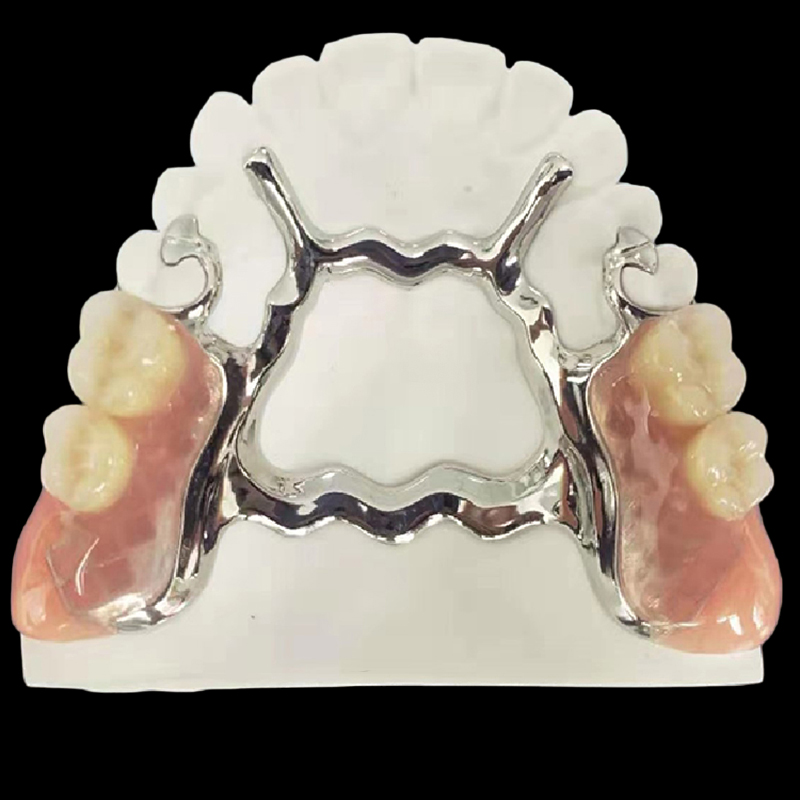 Dental Dentures Metal Framework - Image 2