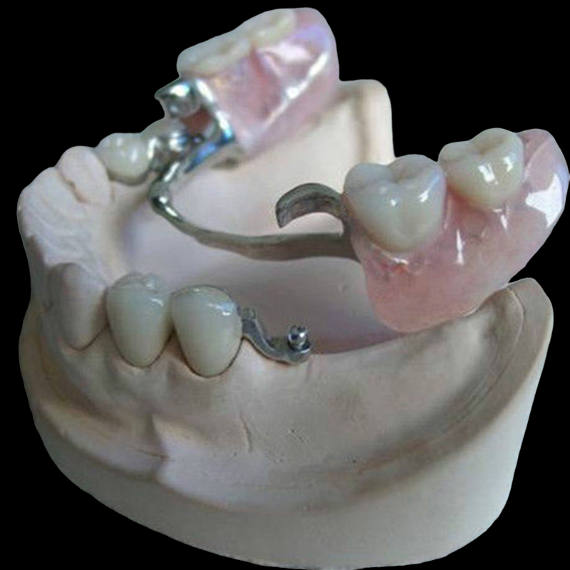 Dental Denture Attachment - Image 2