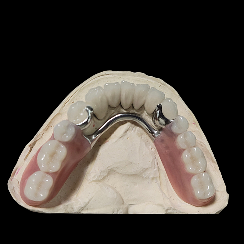 Ball Attachment With Denture - Image 3