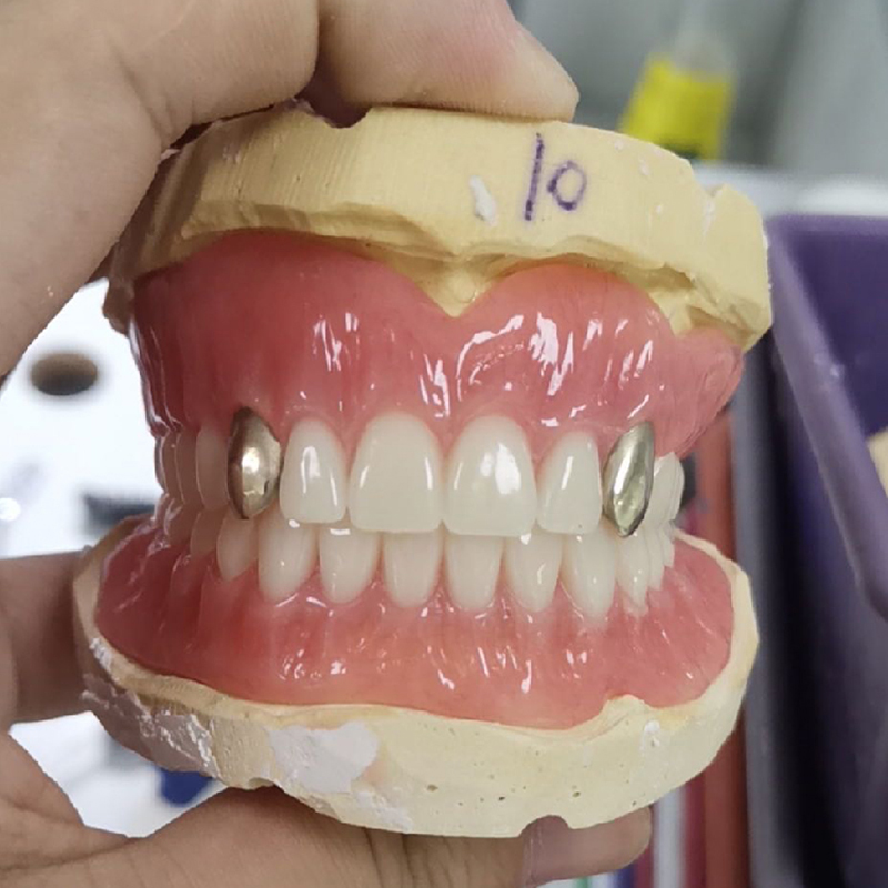 Dental Acrylic Dentures - Image 1