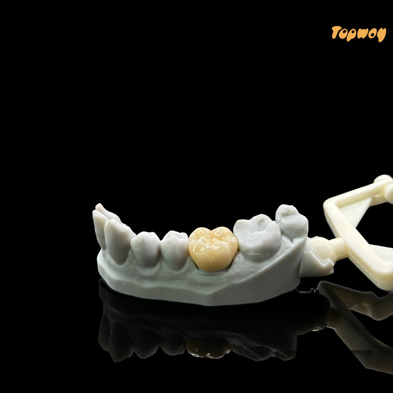 Full Zirconia Dental Case - Image 1