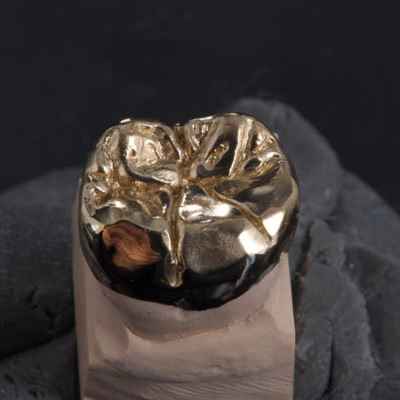 Full Metal Crowns - Image 2