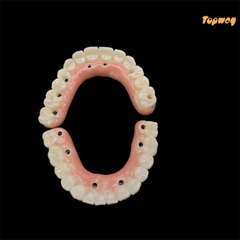Full Implant Zirconia Bridges