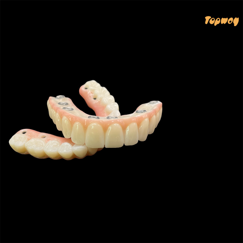 Full Implant Zirconia Bridges - Image 3