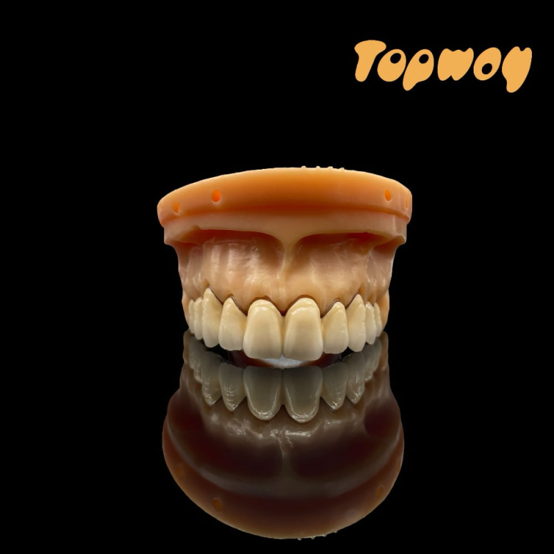 Digital PFM Crowns and Bridge - Image 1