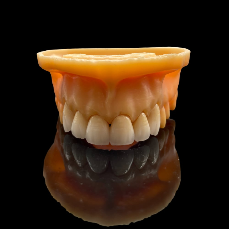 Digital Zirconia Crowns and Bridge - Image 3