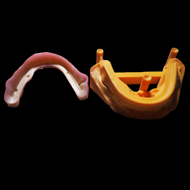  Digital Implant Case