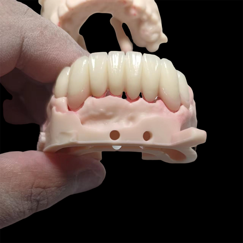 Full Contour Solid Zirconia Crown
