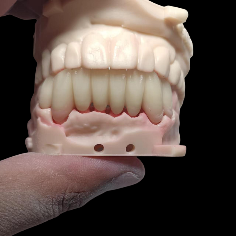 Full Contour Solid Zirconia Crown - Image 2
