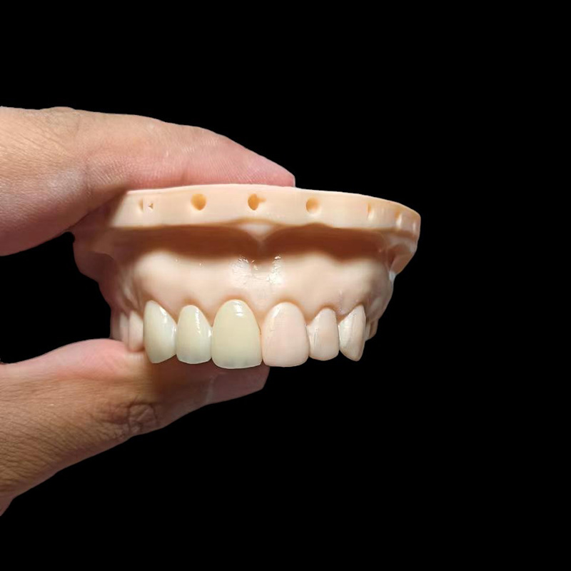 Full Contour Solid Zirconia Crown - Image 3