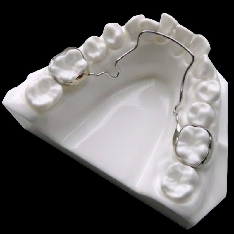 Dental Palatal Expander Service - Image 2