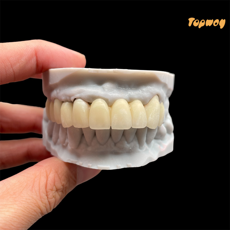 Esthetics Zirconia Dental Lab Crowns Bridge - Image 4