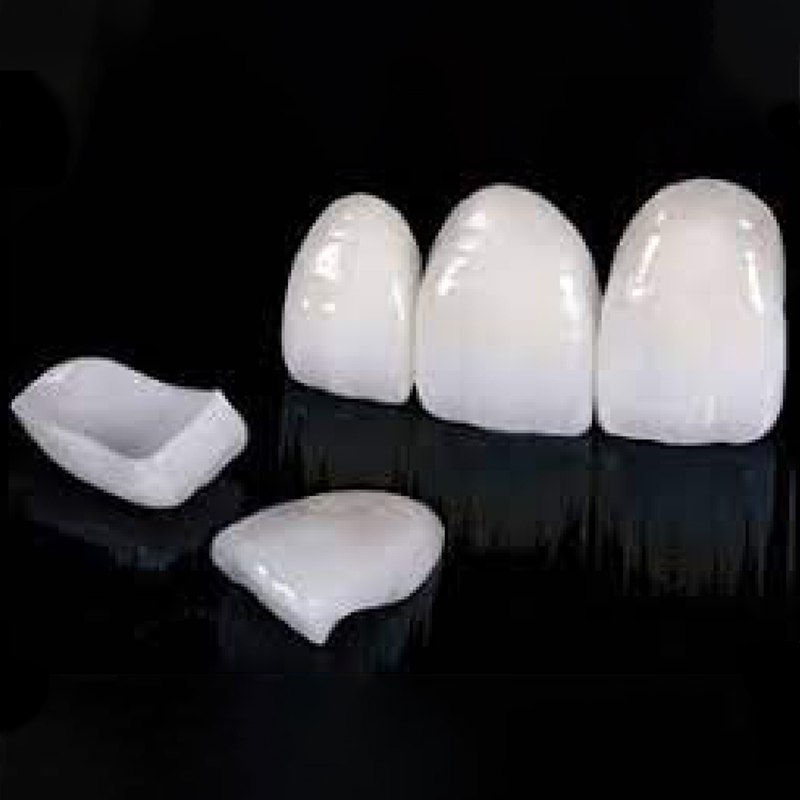 Digital Emax Veneer Esthetics - Image 1