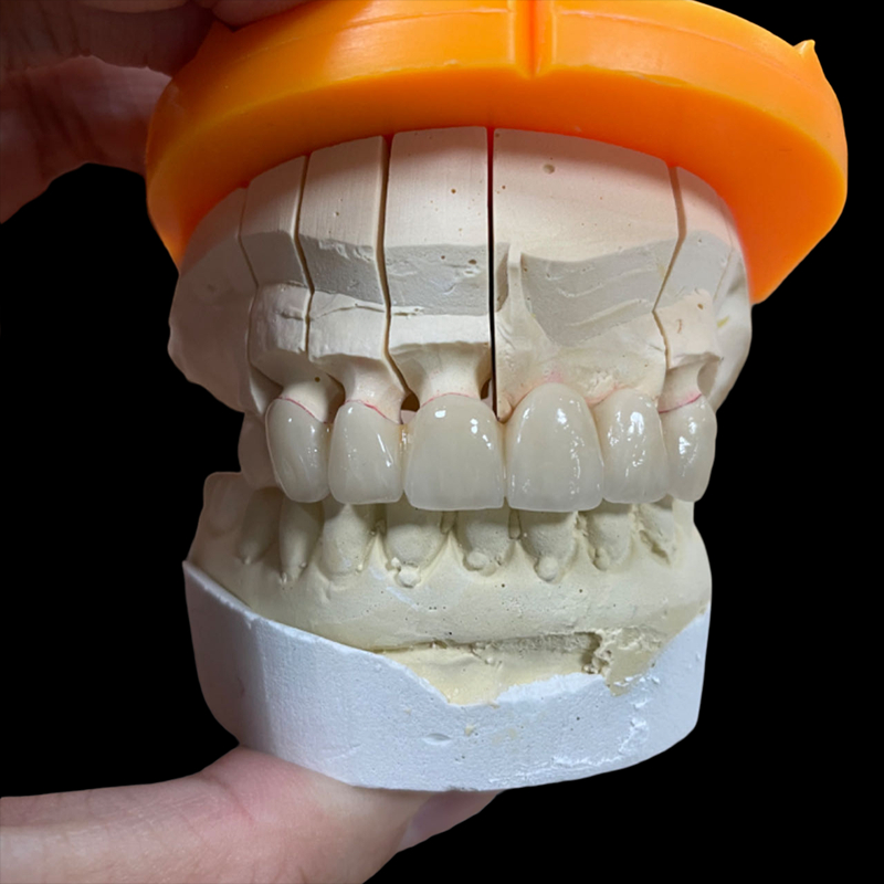 Dental Lab Zirconia Crowns And Bridge - Image 2
