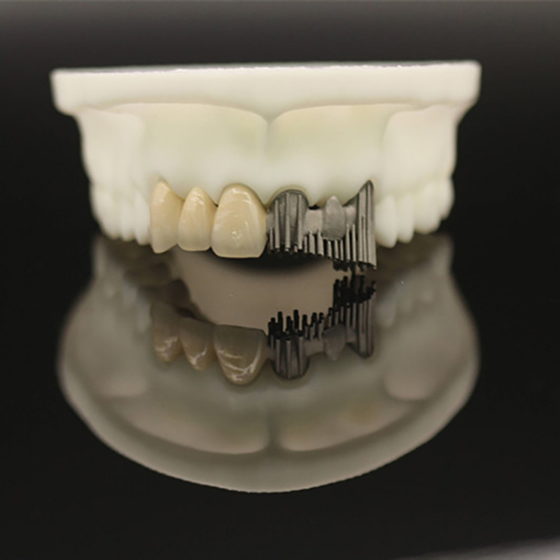 Dental Lab PFM Crowns and Bridge - Image 1