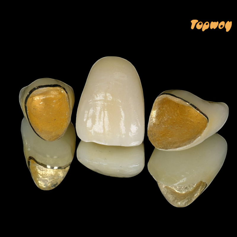 Dental Lab Ceramic PFM Crown - Image 2
