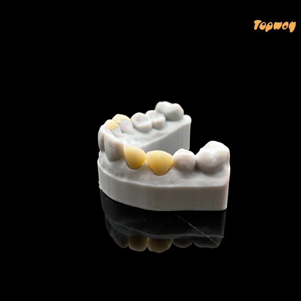 Dental Case Zirconia Veneers