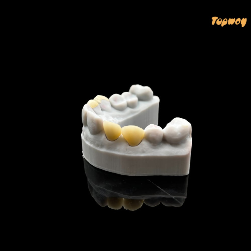 Dental Case Zirconia Veneers - Image 1