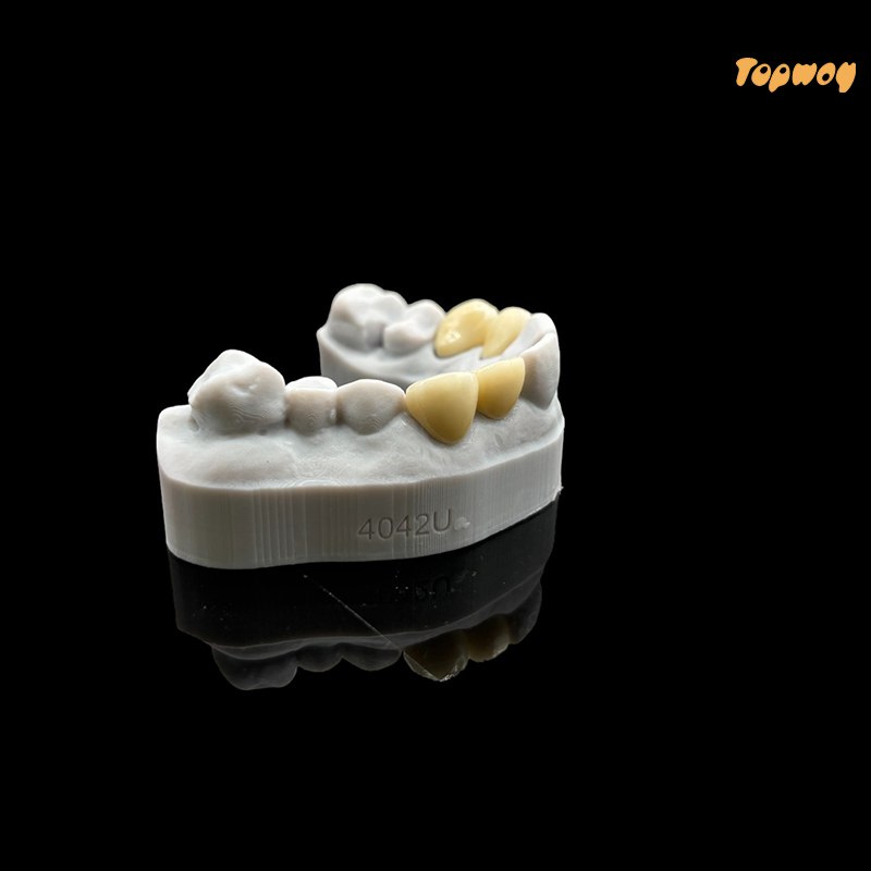 Dental Case Zirconia Veneers - Image 3