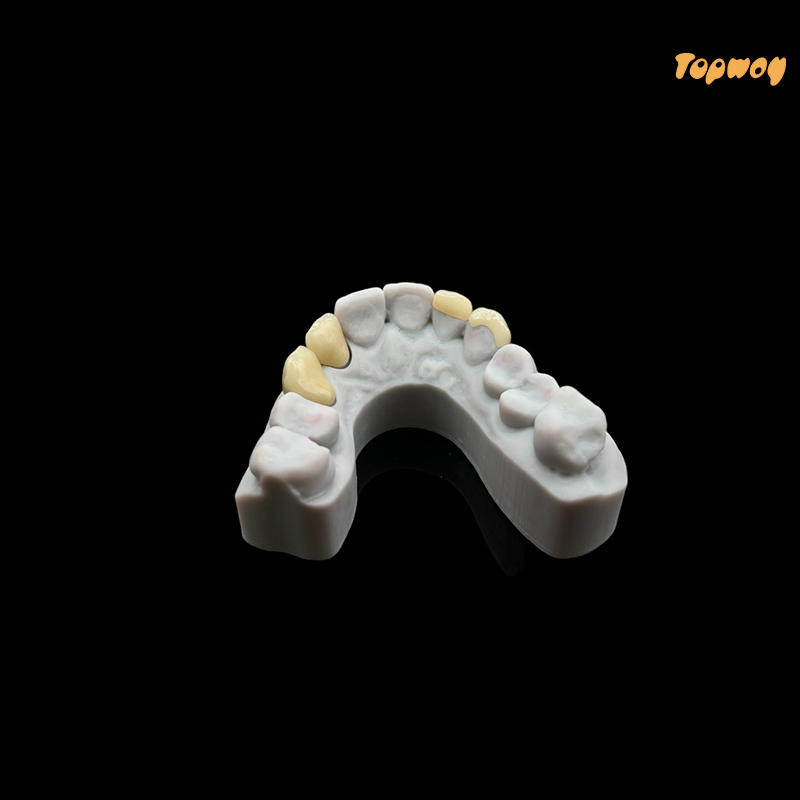 Dental Case Zirconia Veneers - Image 4