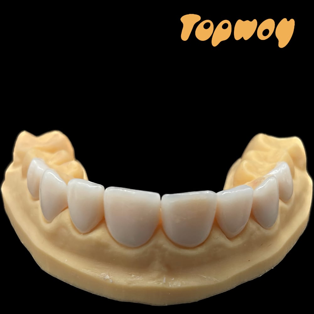 All Ceramic IPS e.max® CAD Crown