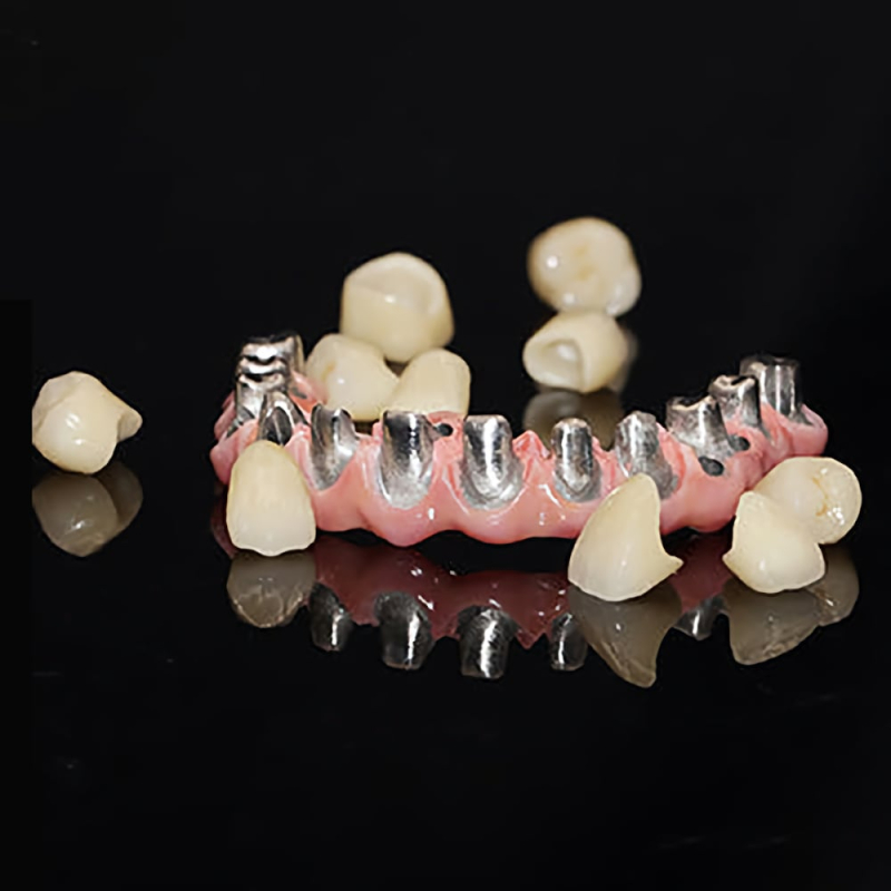 Dental Malo Implant Crown and Bridge Customized - Image 1