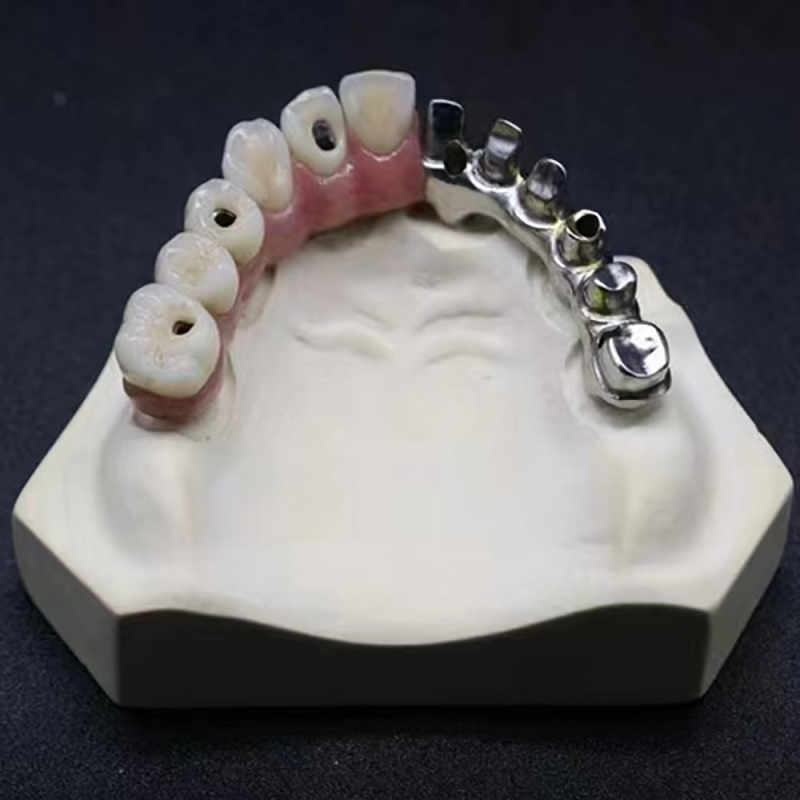 Dental Malo Implant Crown and Bridge Customized - Image 4