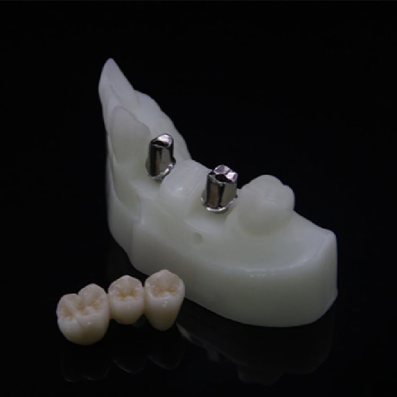 Custom Zirconia Implant Abutment - Image 3
