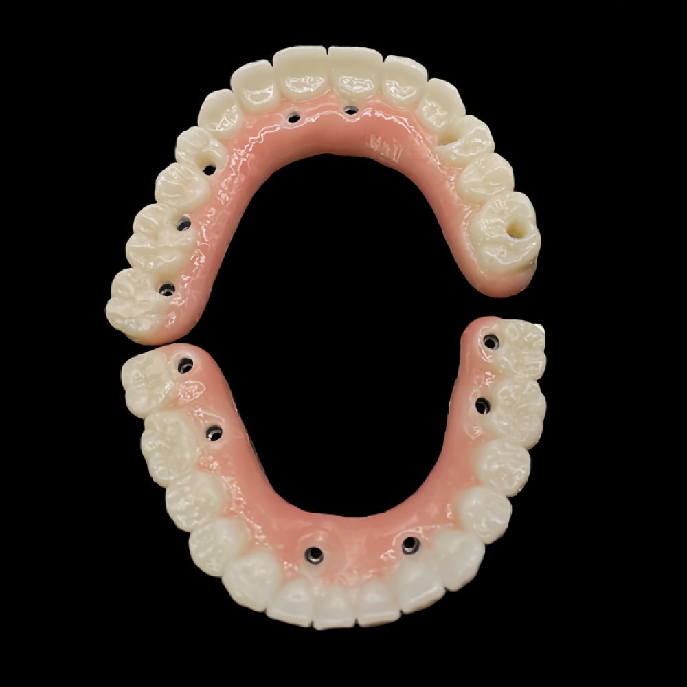 All On 4 Dental Implants