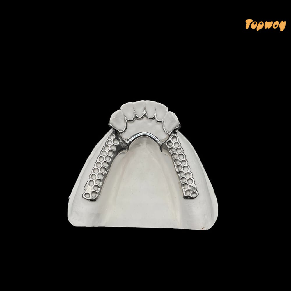 Cast Partial Dentures