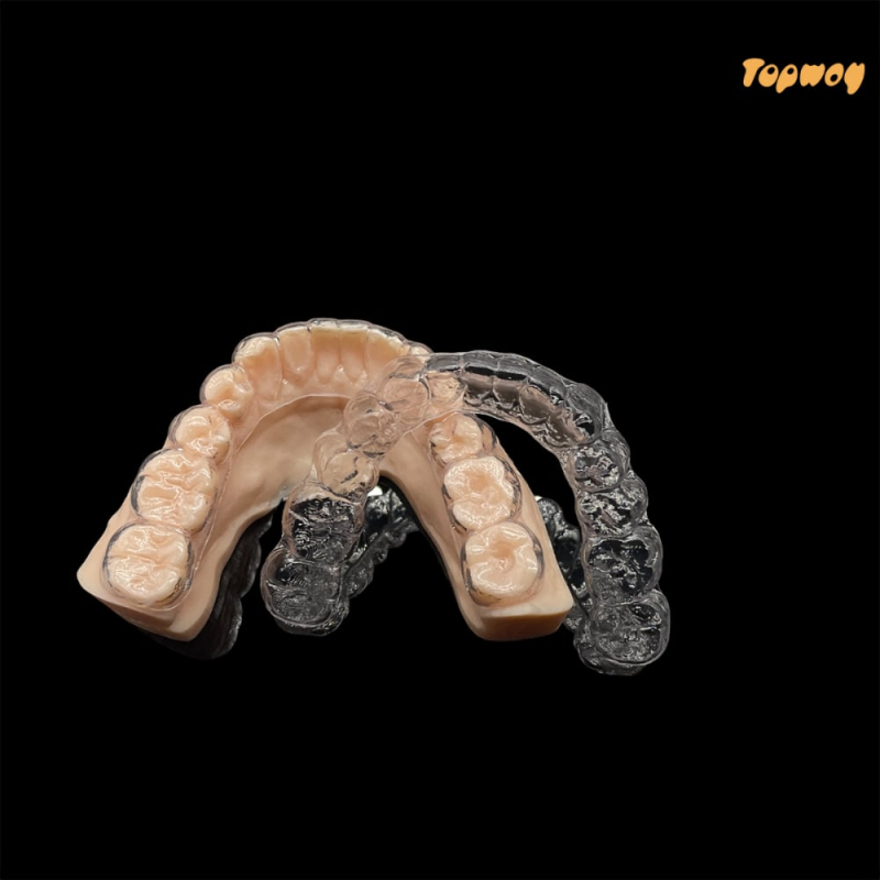 Invisalign Treatment - Image 1