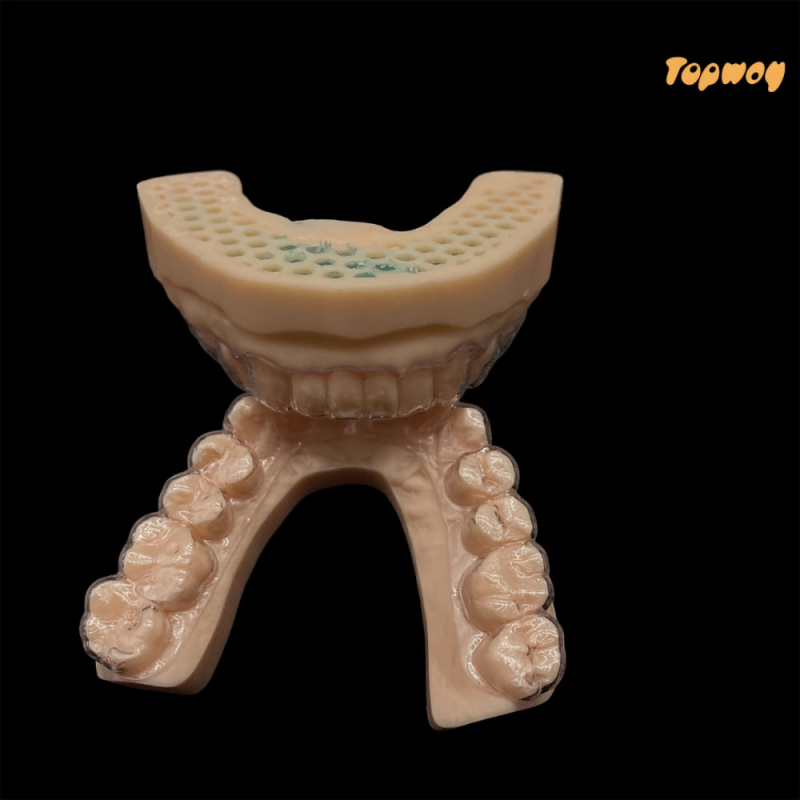 Invisalign Treatment - Image 4